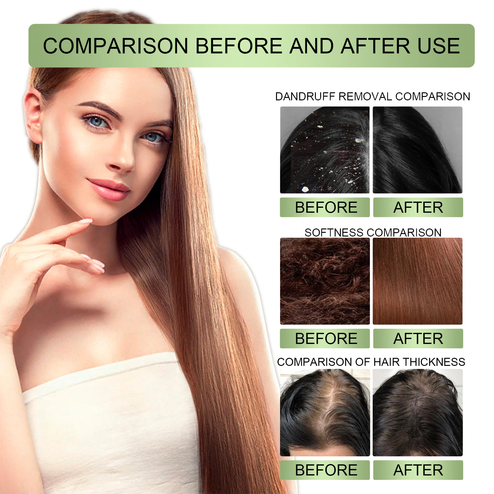 Fast Hair Growth Essential Oil India Adivasi Rosemary Damaged Hydrate Nourish Scalp Serum Reduce Dandruff Herbal Hair Care 100ml