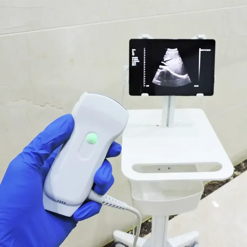 3-in-1 Wireless Pocket Ultrasound Probe – WiFi Smartphone-Compatible for Android & iOS