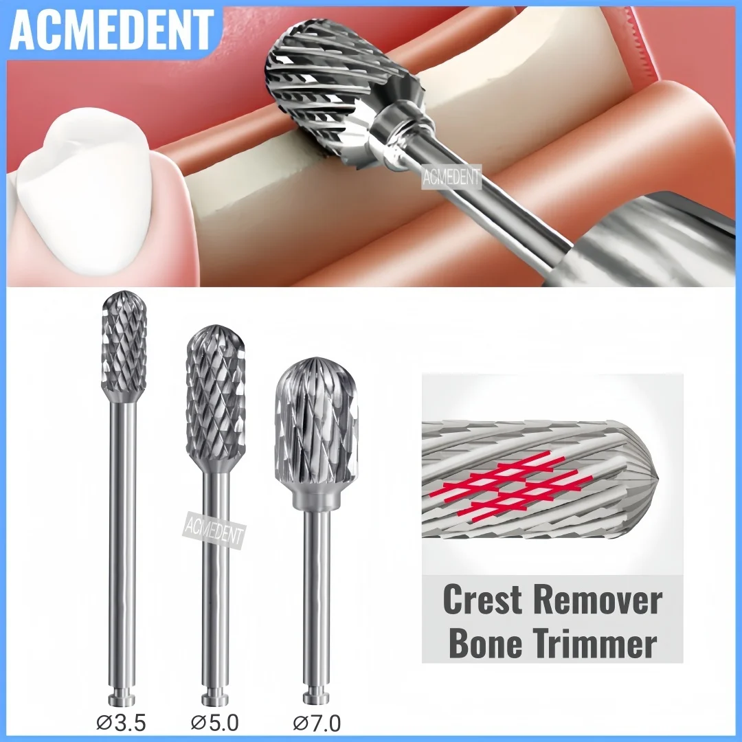 3 أحجام الأسنان الأناناس الحفر العظام التشذيب الحفر كريست مزيل شكل النحت ريدج الكنتوري GBR الأزيز #1