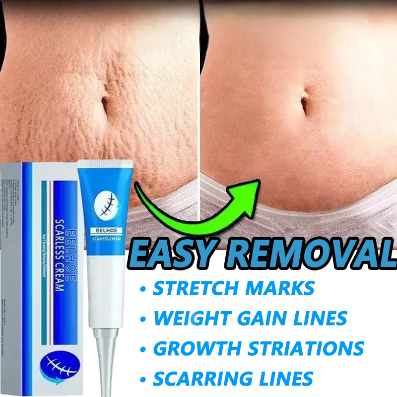 

Remove Stretch Mark Cream Hydrates and moisturizes Anti-wrinkle Anti-aging Maternal Firms tightens Skin Repair Remove Pregnancy