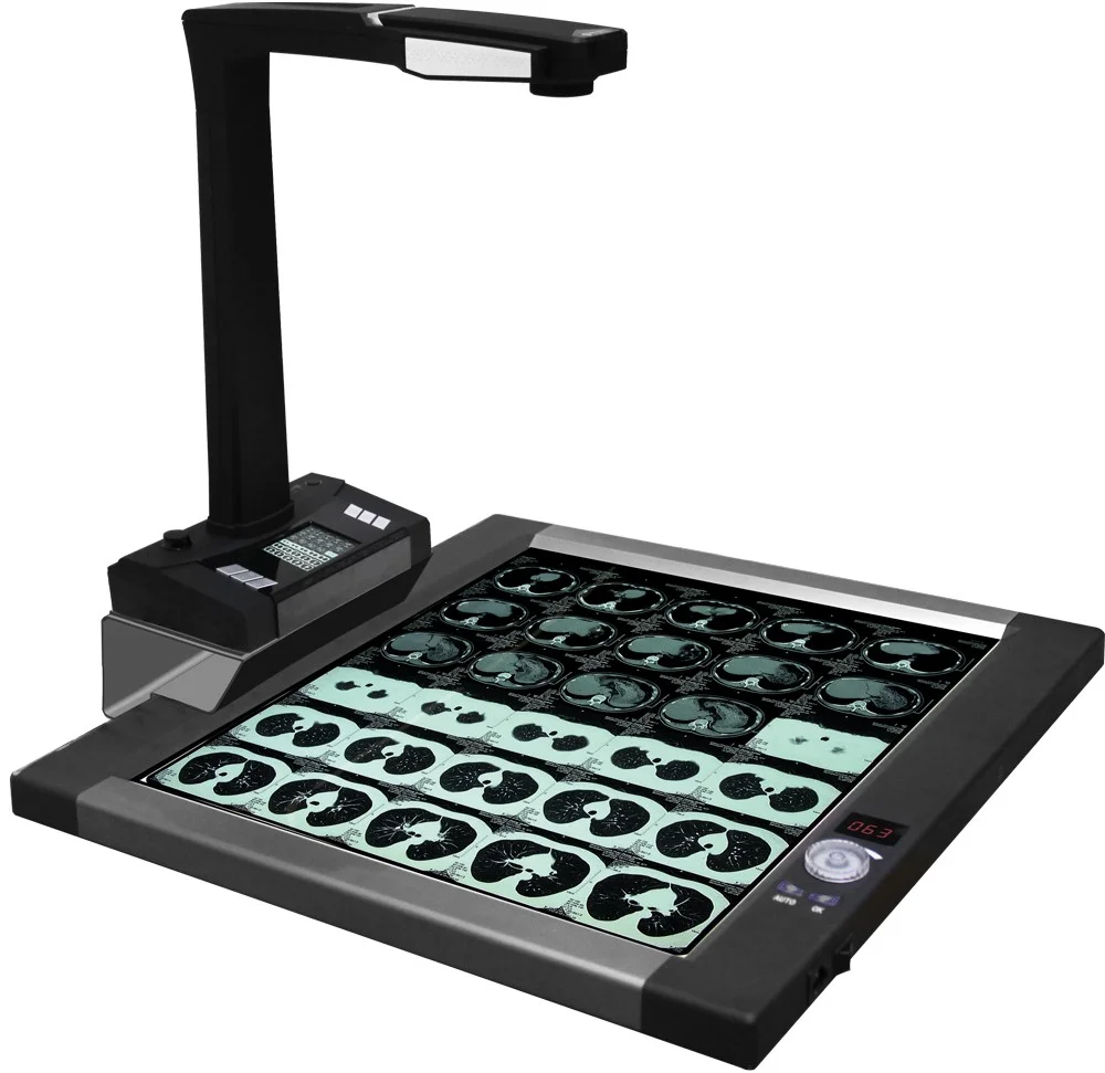 CT160 16MP High Brightness Adjustable Medical X-ray Film Scanner And Viewer CT Scanner Medical LED Negative Film
