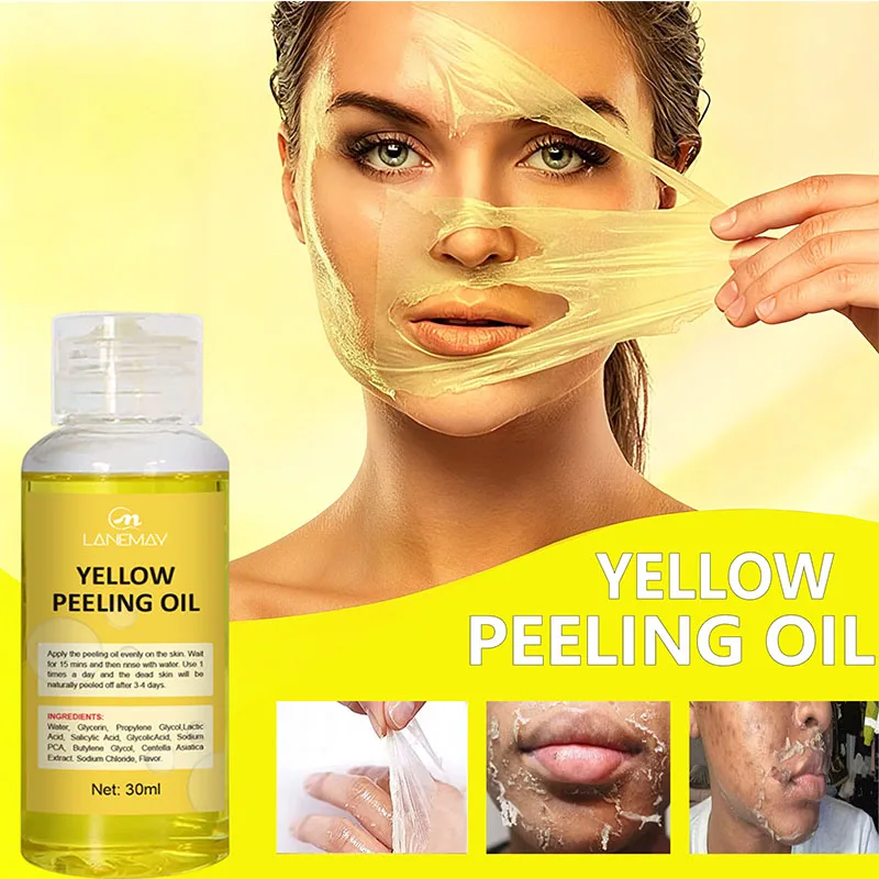 Strong Yellow Peeling Oil Bleach Dark Skin Whiten Lotion Lighten Body Elbow Knee Hand Exfoliate Dead Skin Nourish Even Skin Tone