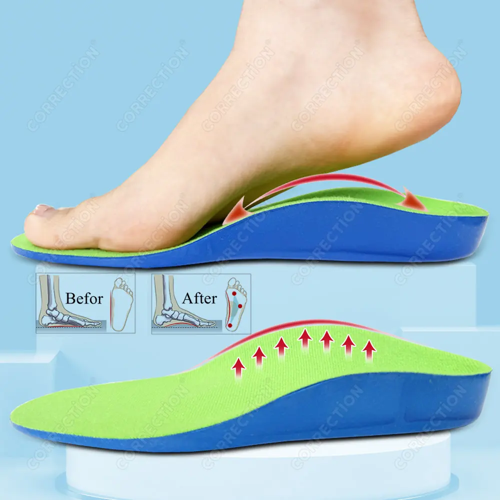 CORRECTiON Kids 3D Orthopedic Insoles Arch Support for Flat Feet XO Legs Shock Absorbing Sport Pads for Children’s Foot Care
