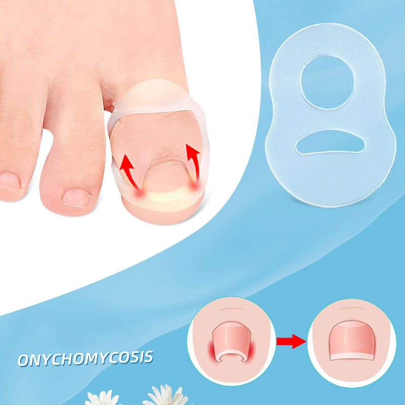 Silicone Ingrown Toenail Correction Tool Invisible Ingrown Toe Nail Treatment Elastic Straightening Clip Brace Pedicure Tool