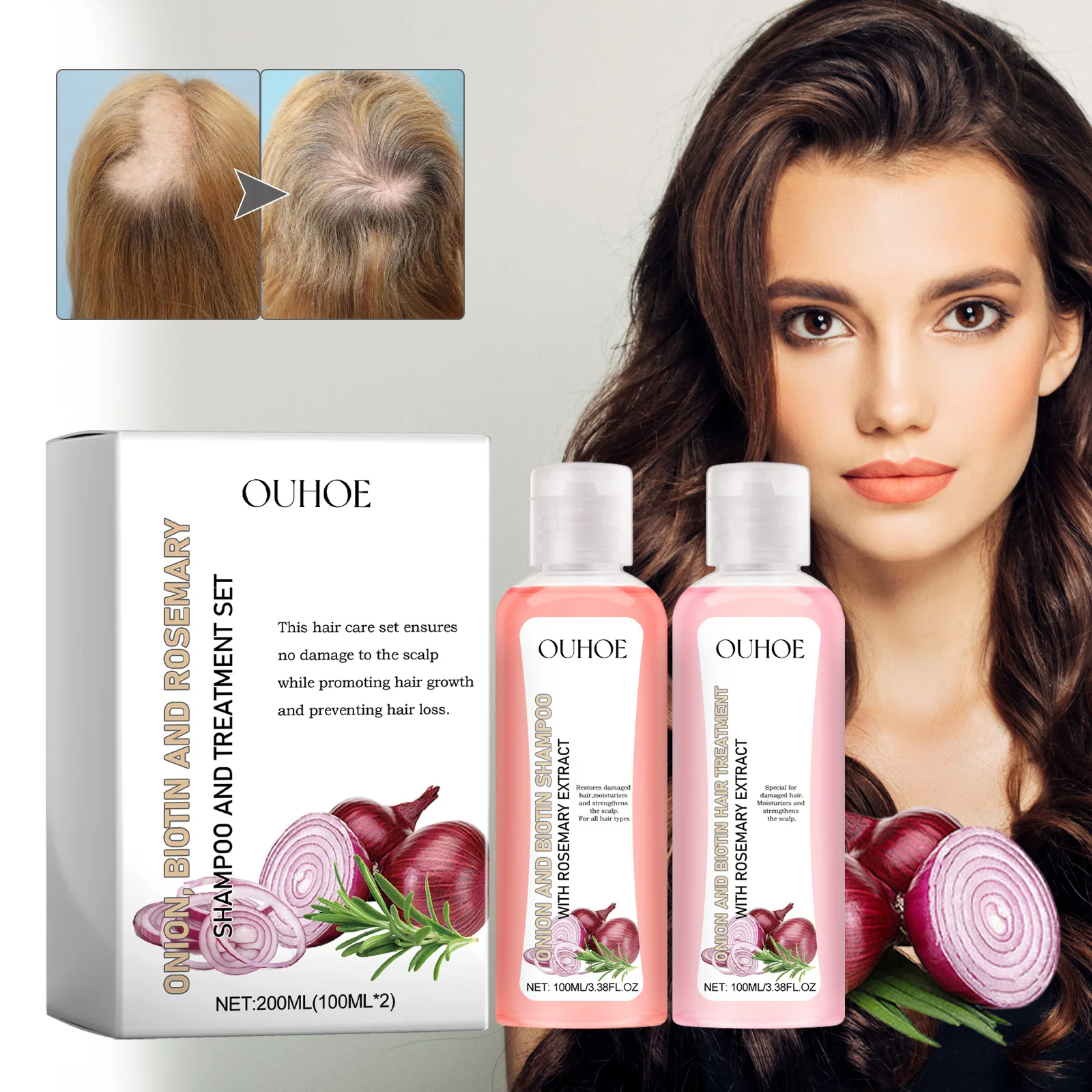 Onion Biotin Rosemary Shampoo and Condicionador Set Hairs Nourish Hairs Roots Hair Growth Hair Care Product Sets 컨디셔너 트리트먼트