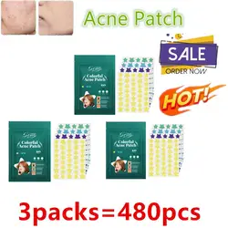 3Pack Puistje Patches Beauty Acne Tools Stervormige Puistje Acne Concealer Fade Face Spot Reparatie Voor Pit Breakouts Spots Dot