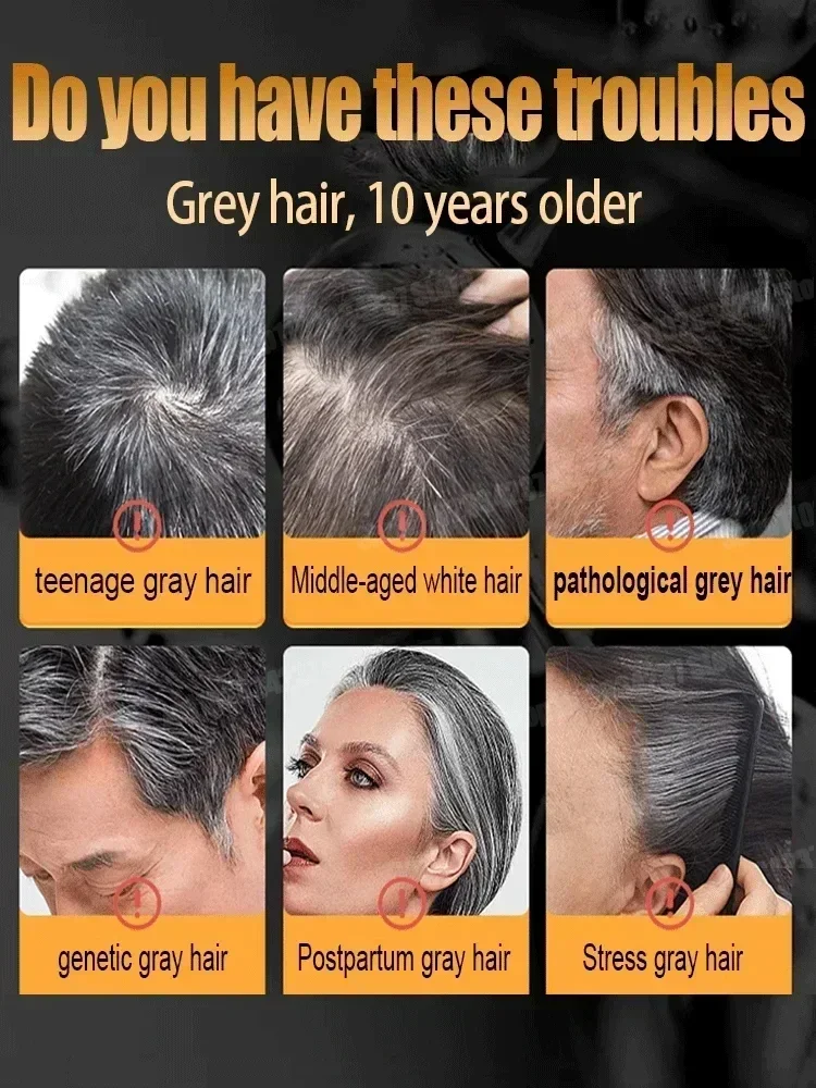 Grey Coverage Bar Shampoo Repair Gray Natural Anti-Grey Hair Essence Serum Smoothing Nourishing Dandruff Natural Darkening Soap