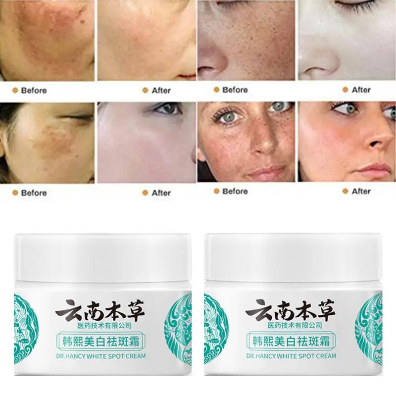 20/30/50g Herb Powerful Whitening Cream Freckle Remove Acne Spots Melanin Dark Spots Face Moisturizing Face Skin Care Beauty