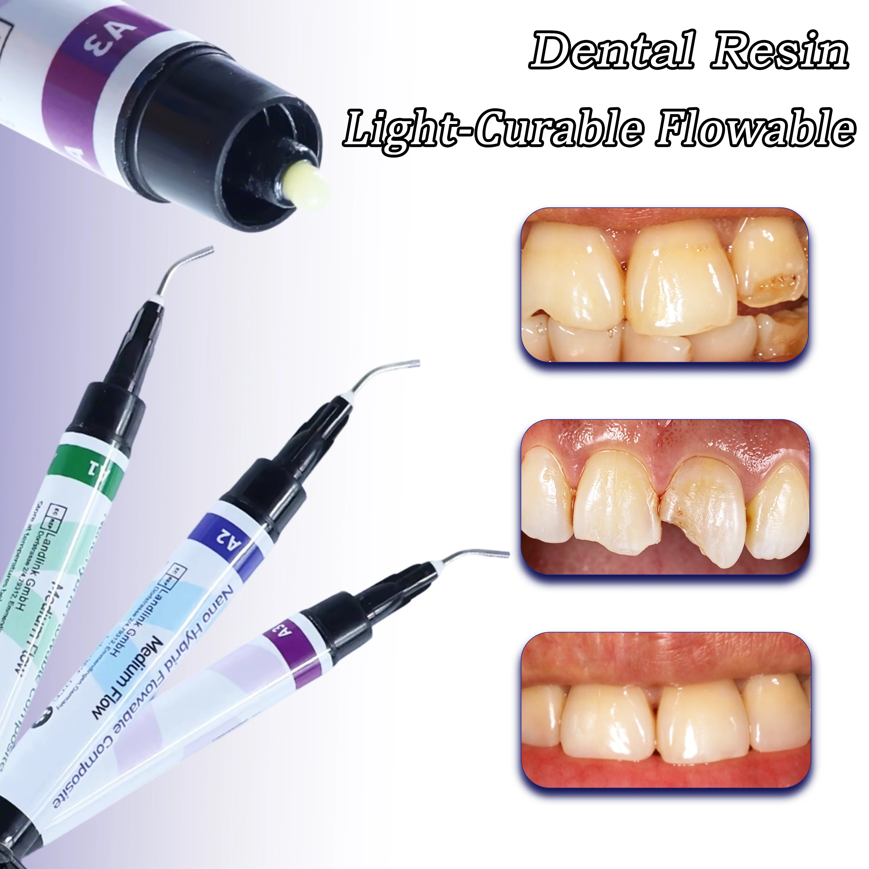 Resina Compuesta Fluida Fotopolimerizable Dental A1 A2 A3 A3.5 con Gel Grabador y Adhesivo de Primera Calidad para Restauración de Obturaciones Orales