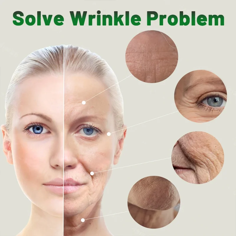 Anti-Aging Capsule Remove Facial Fine Lines Neck Wrinkles Firming Nicotinamide Riboside Alternative  Natural Energy