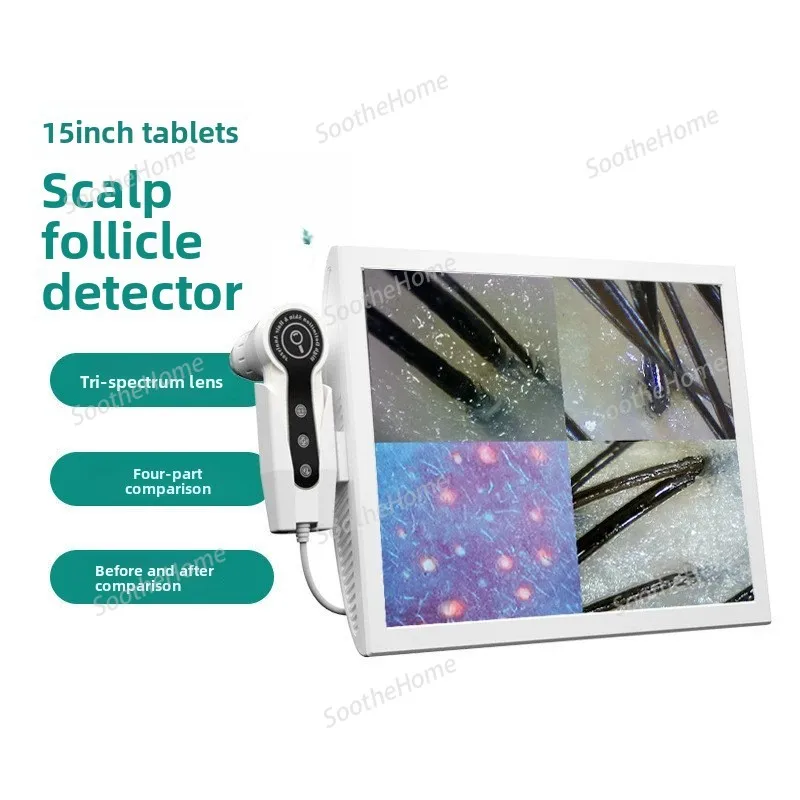 Scalp Detection Instrument, Hair Loss Follicle High-definition Analyzer, Beauty Salon Skin and Hair Testing Instrument