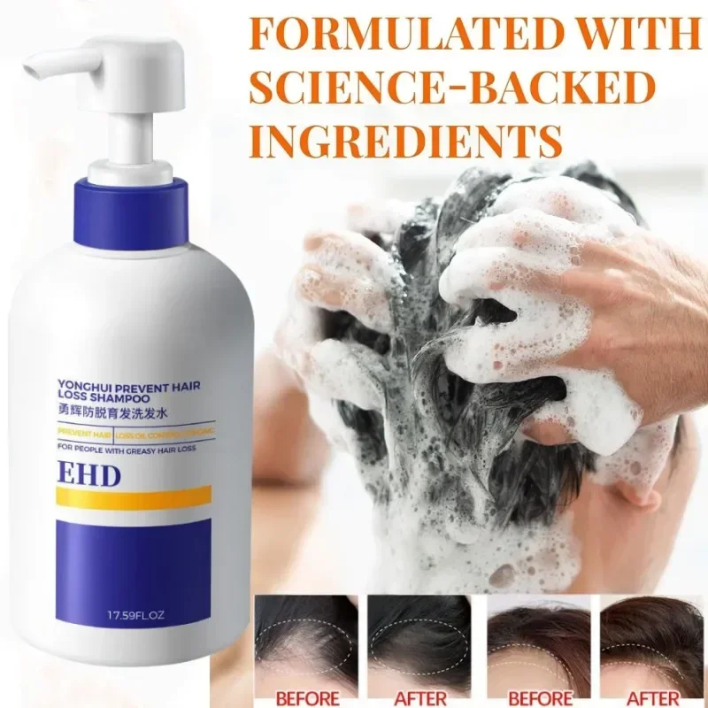 

EHD Natural Anti-hair Loss Shampoo Nourishes Scalp Roots, Fights Hair Loss, Promotes Dense Growth and Enhances Hair Texture