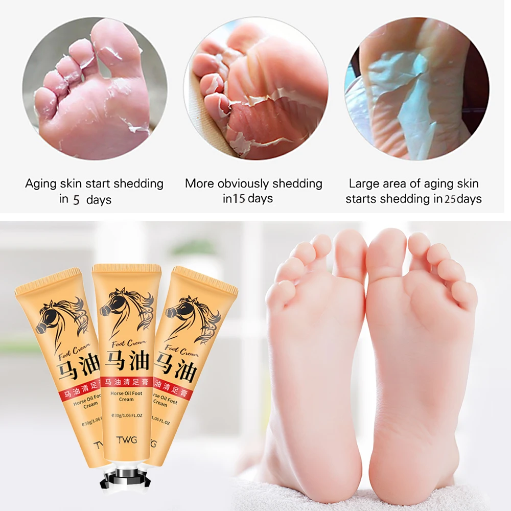 Anti Crack Foot Cream tallone riparazione screpolata crema all'olio di cavallo rimozione liscia pelle morta callo Anti-essiccazione piedi per le mani cura della pelle 30g