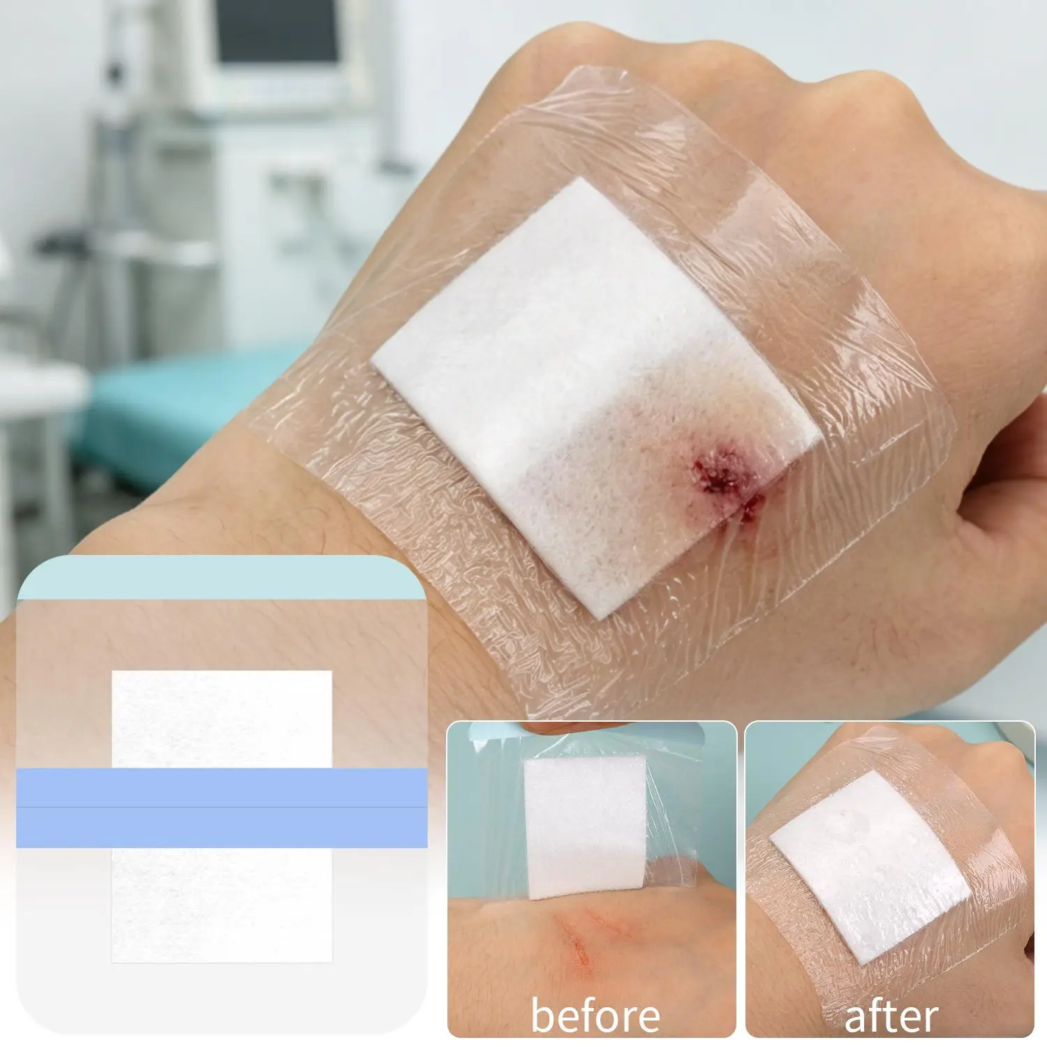 

1/50Sheet Clear PU Wound Dressing Patch Transparent Self-Adhesive Bandages for Daily Adventures Bathing Swimming Outdoor Sports