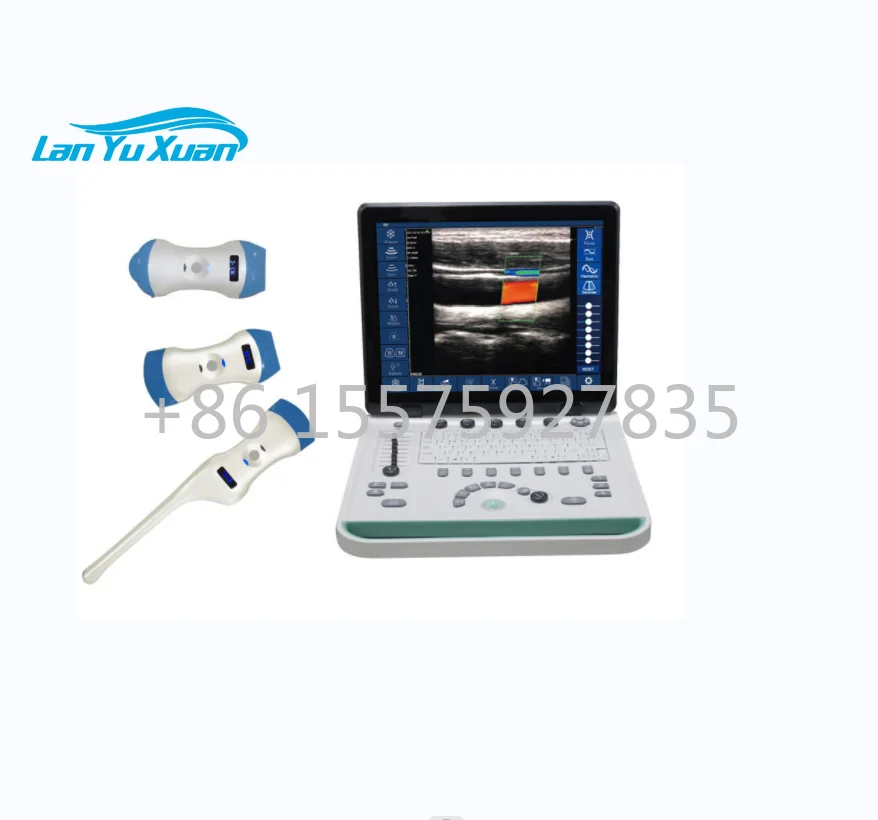 Color Doppler Ultrasound system wifi connect