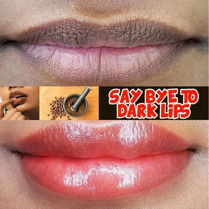 Whitening Remove Dark Lip Balm Moisturizing Cream Hyaluronic Acid Exfoliating Dead Skin Lightening Pigment Care Beauty Health