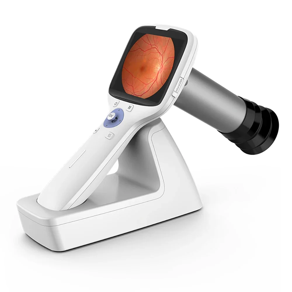 High Resolution Portable Handheld Fundus Camera With Build-In Battery