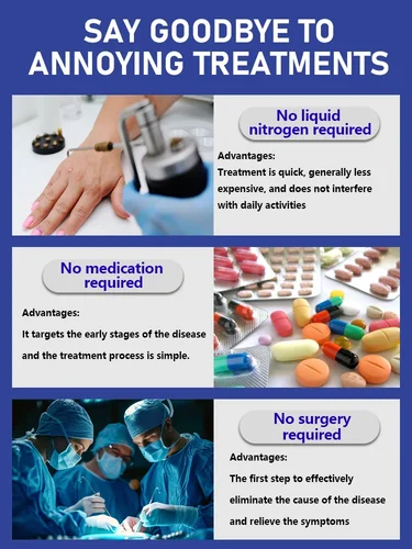 Imagen 2 del producto Verrugas mejoradas de 1a generación reparación de raíz de verrugas uickly 99