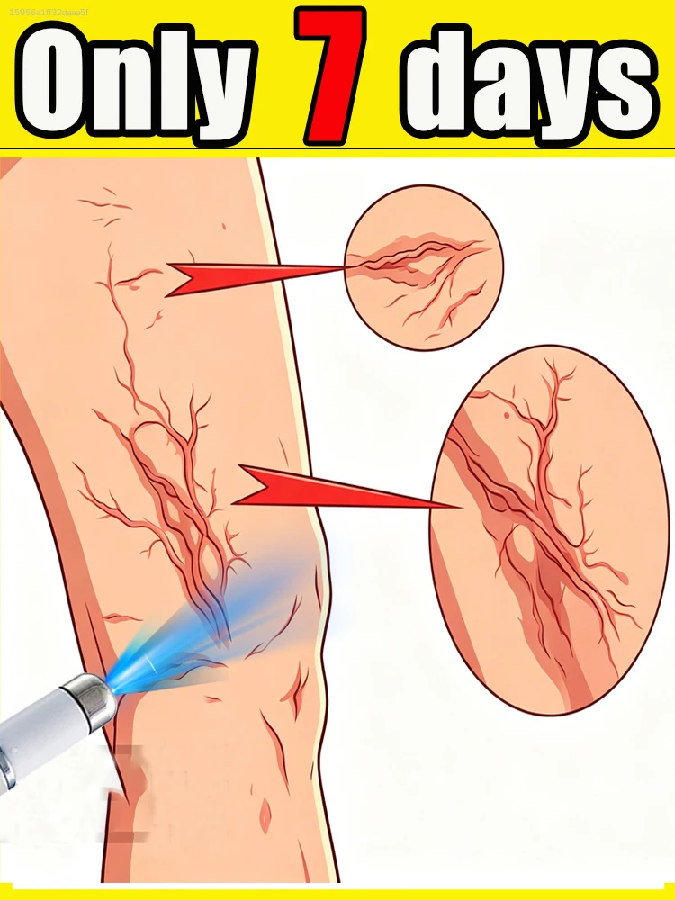 

relieve fatigue stand leg