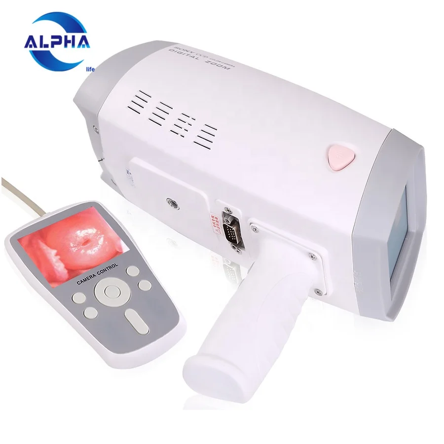 

portable handheld digital camera sony colposcope