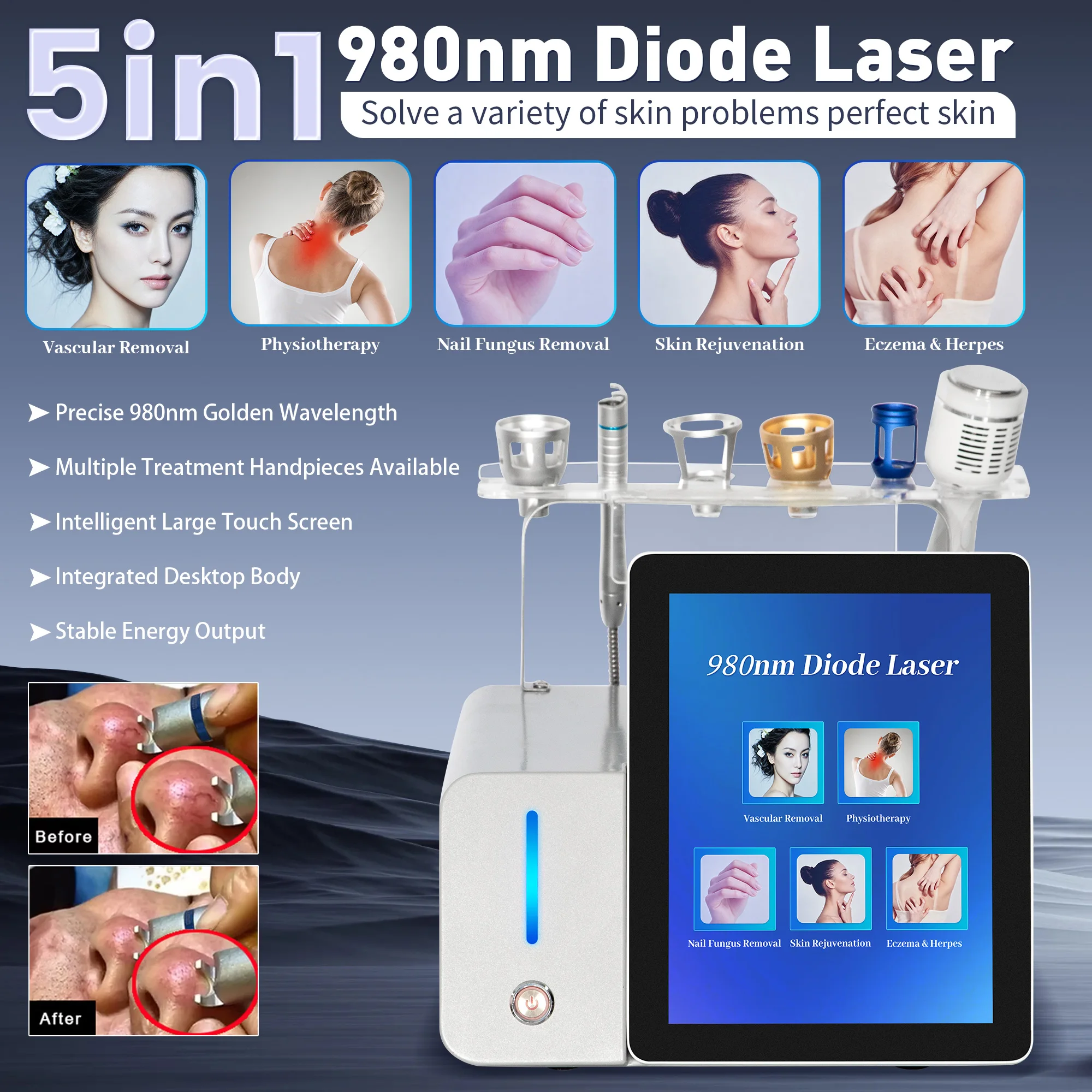 980nm 5 in 1 다이오드 광학 미용 기기 휴대용 - Spa Wellness And Beauty 리뷰 및 가격