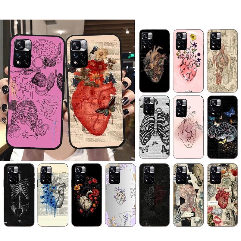 Heart Anatomy Skull Bones Phone Case For Xiaomi Redmi note 13 12 Pro 11S 11 10 Pro 10S 12S Redmi 13 10 13C 12C 14C