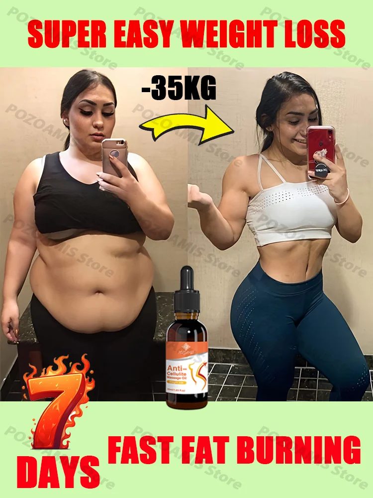 lose-weight