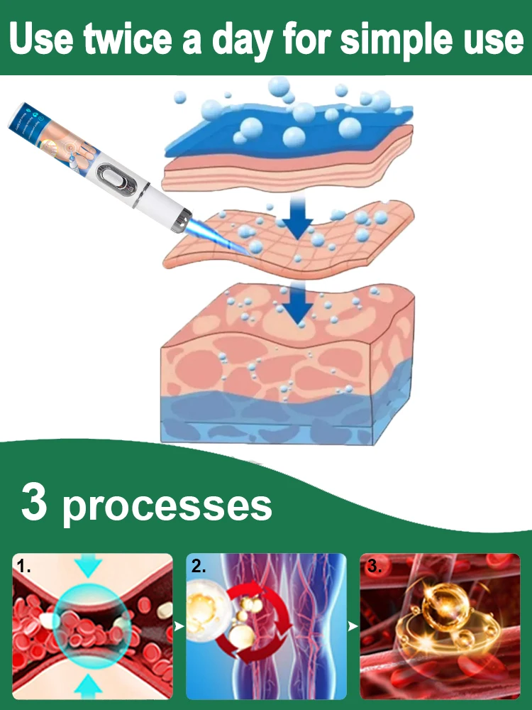 Geração-2 Laser diz adeus para remover verrugas rapidamente