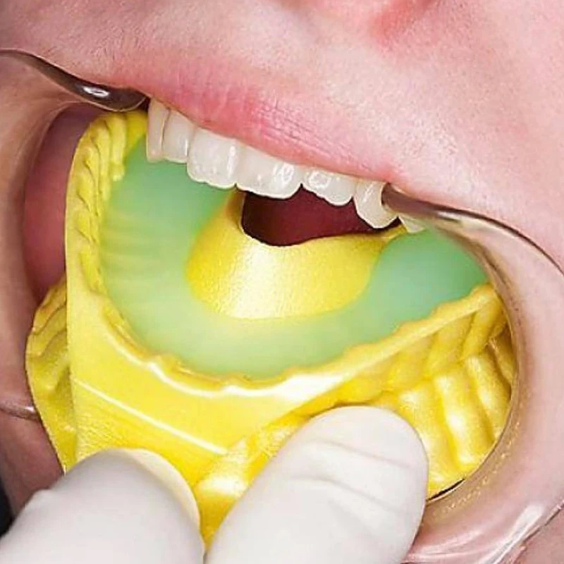 Bandeja de doble arco desechable de fluoruro Dental, bandejas de espuma de gel, materiales dentales para niños, suministros dentales pediátricos, grandes, medianos y pequeños