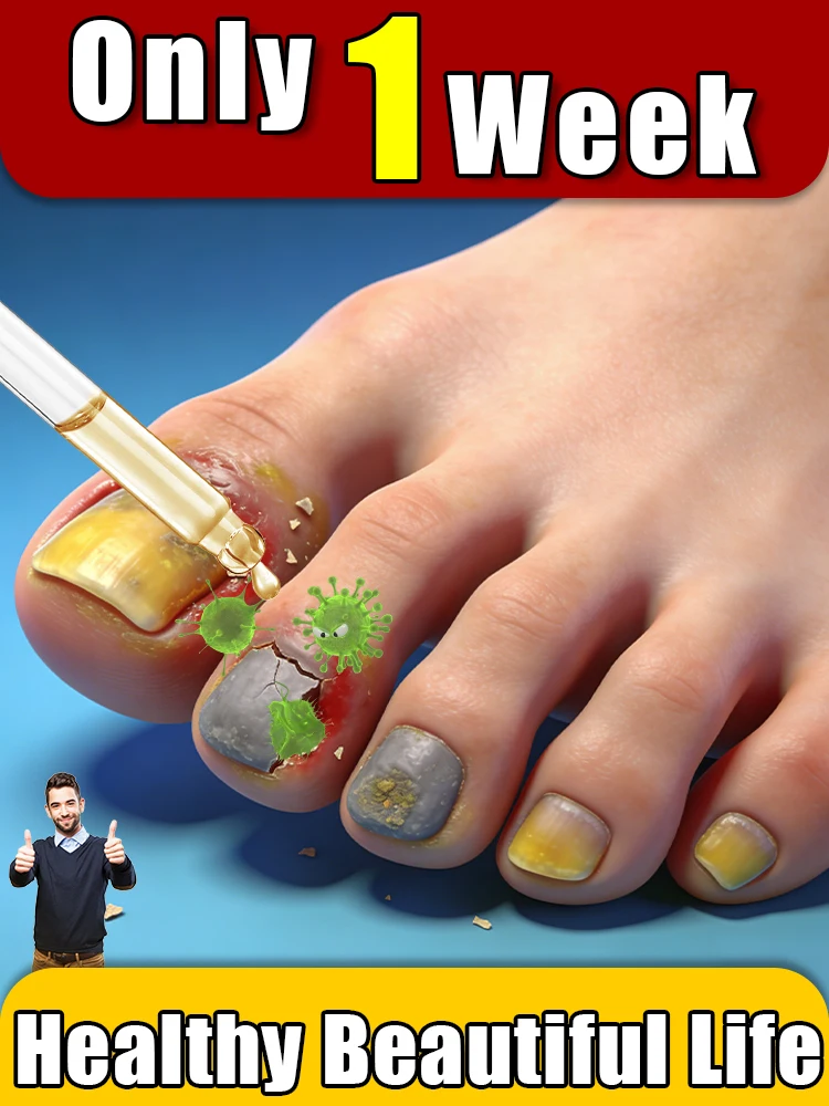 

Professional level protection of nail health, bidding farewell to thickening, turbidity, and layering, restoring luster