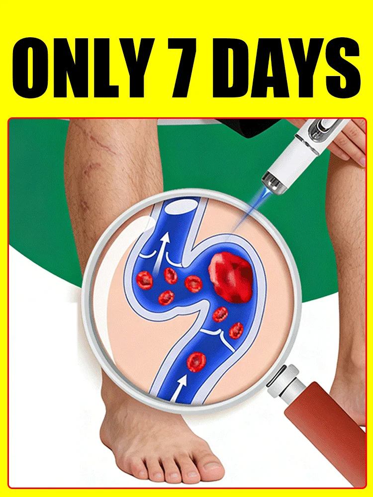 Stylo laser pour le traitement des jambes de vers de terre, pointeur laser amélioré révolutionnaire en 2025