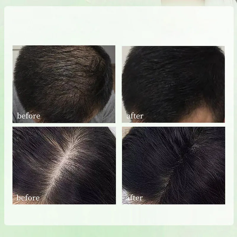 Natürliche Kräuter-Shampoo-Seife, handgemachte Usman-Gras-Seife, nährende Haare, Ölkontrolle, erfrischende, flauschige und beruhigende Haarpflege – Detail 4
