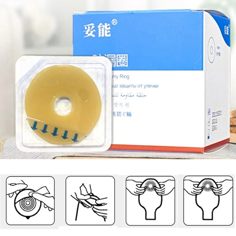 10Pcs Ostomy Bag Paste Ring Baseplates Stoma Leakproof Ring Prevent Protect Skin
