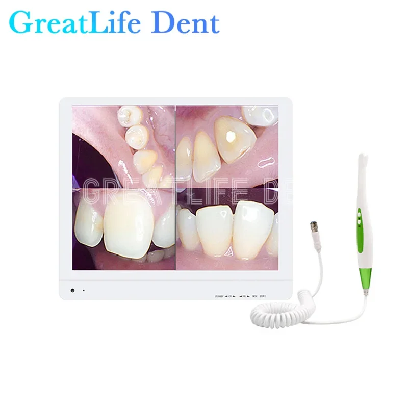 GreatLife Dent 17-дюймовая HD1600 10-дюймовая стандартная холодная стандартная стоматологическая Usb Проводная внутриоральная интраоральная камера Wi-Fi беспроводная