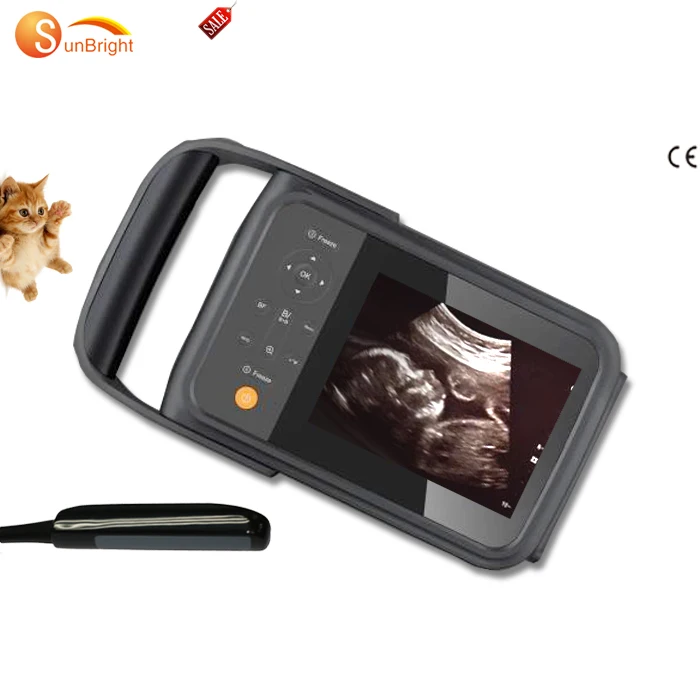 

CE approved medical hand held ultrasound machine