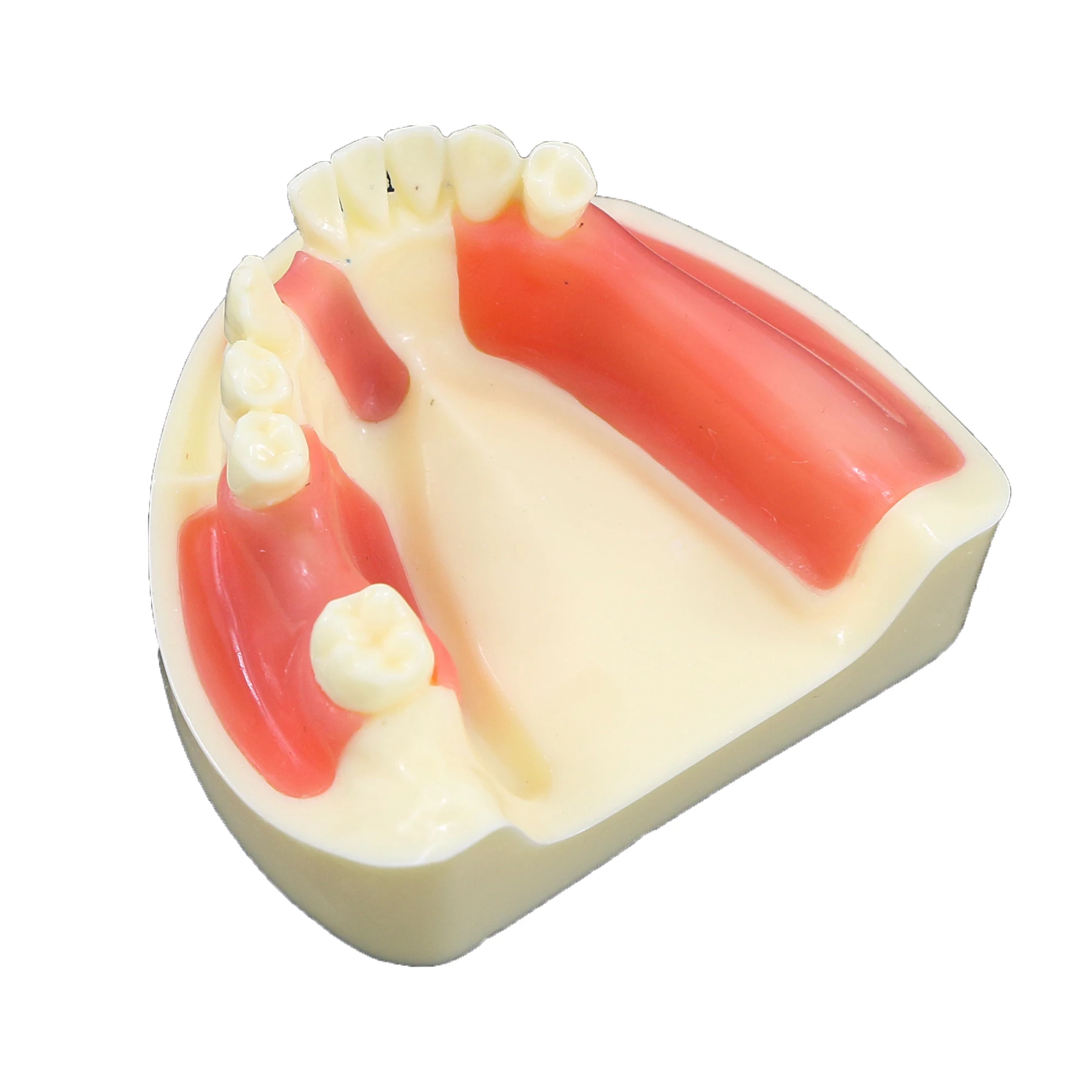 Dental Model  Mandibular Jaw Implant  Study Education Teach with Gingiva for Flap and Drilling Practice