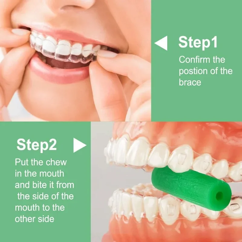 Colorido Dental Silicone Brace Extractor, Aligner Chewias Set, Bandeja Assentos, Dentes Aligner Remoção Ferramenta, 1Pc