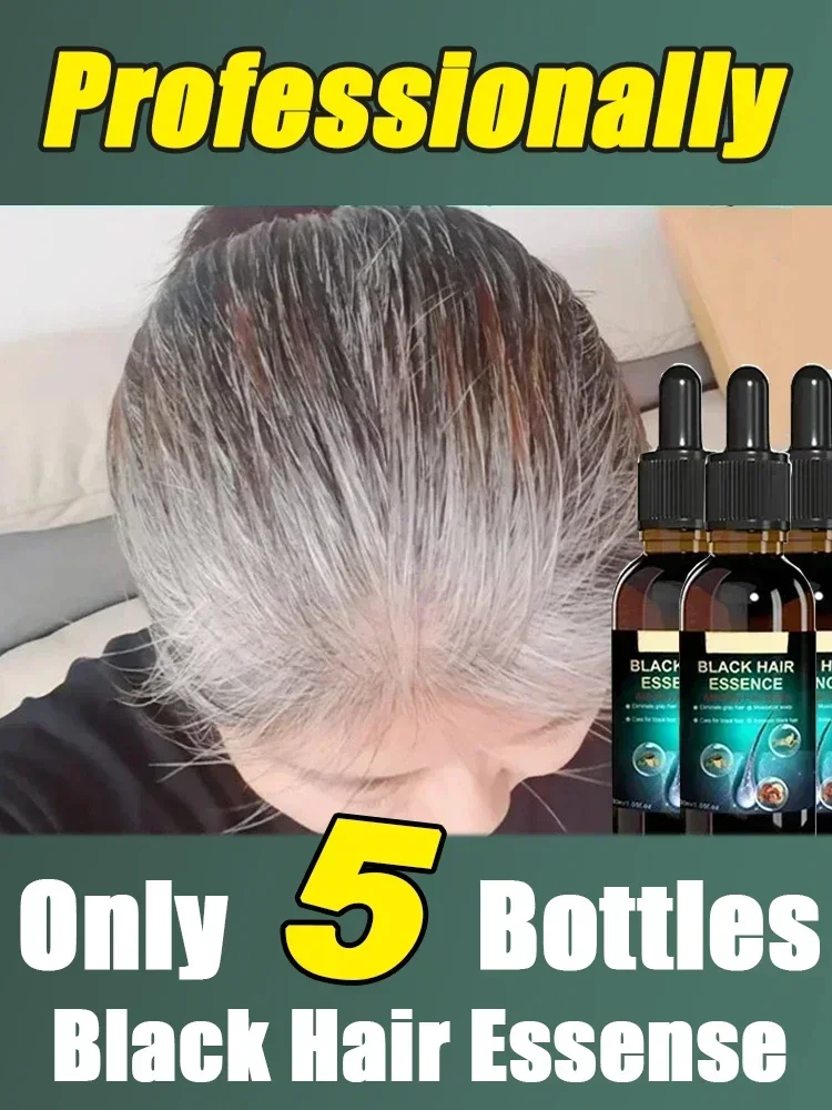 

Gray White Hair Treatment Serum Liquid White To Black Natural Color Repair Nourish Product Anti Loss Hair Care Men Women