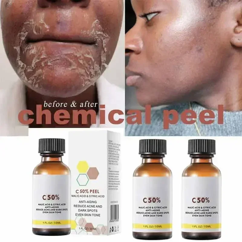 Óleo Peeling Esfoliante para Facial, Hidratante, Clareamento, Nutritivo, Reparação, Creme Facial, Cuidados com a Pele Beleza