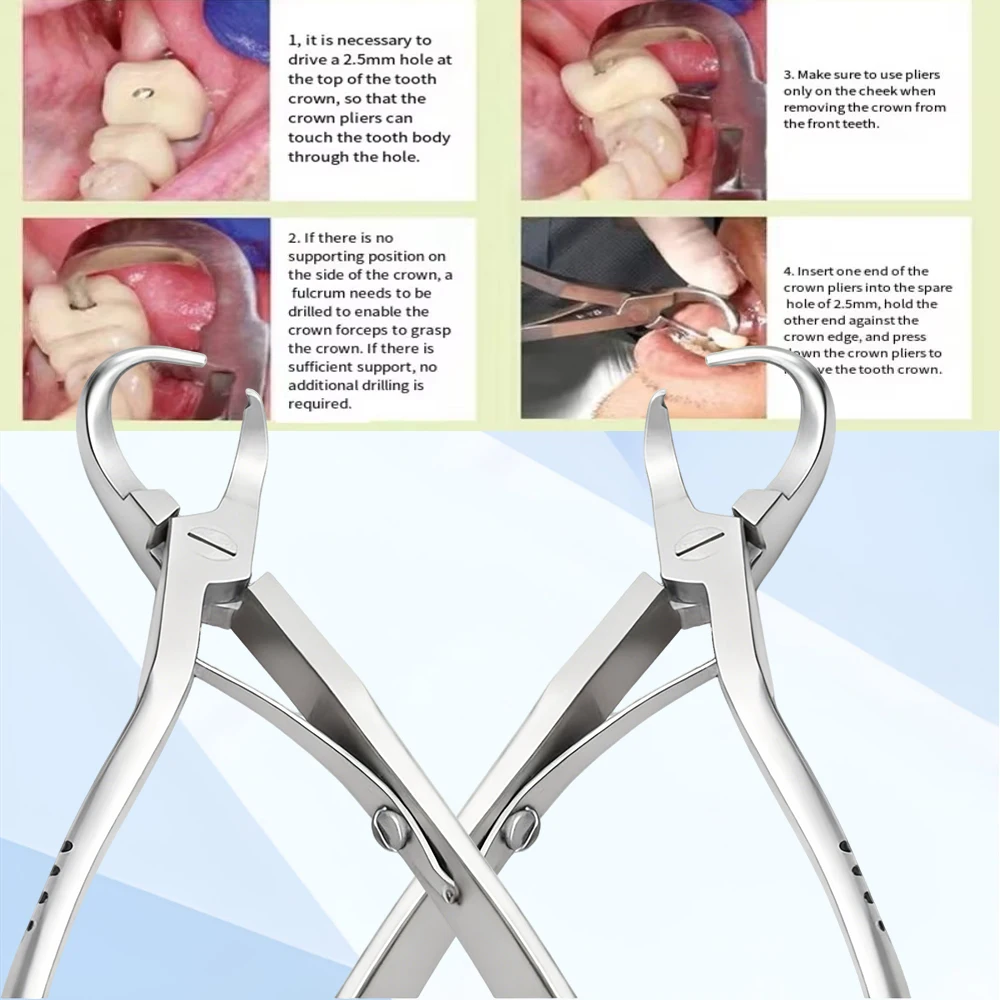 

Dental Crown Remover Plier for Temporary Crown Removal Dentist Tools Surgical Instrument Stainless Steel Instrument