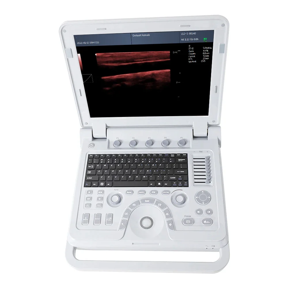 CONTEC CMS600P2 Plus Promotion Portable CE 12.1 Inch color Convex Ultrasound Scanner