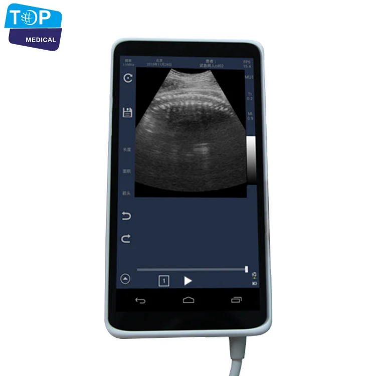 TOP-A1026 Wifi Mini Ultrasound Machine Price Cheapest Portable Ultrasonic Diagnosis System CE,ISO Approved Color Doppler