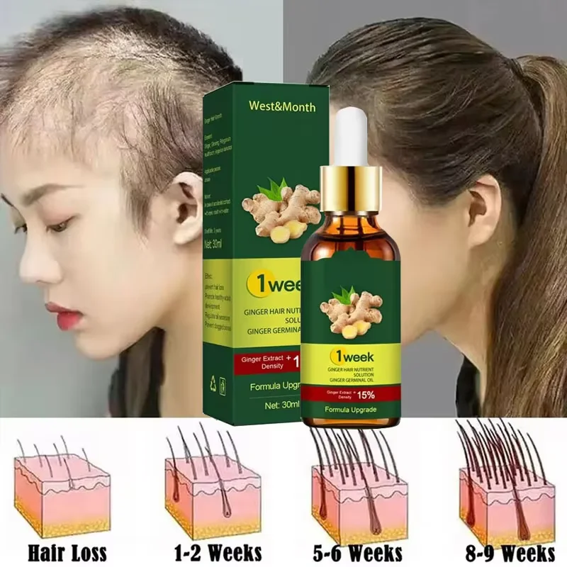 

7 Days Ginger Hair Growth Products Fast Promote Hair Regrowth Serum Anti Hair Loss Scalp Treatment Baldness Care Essential Oils