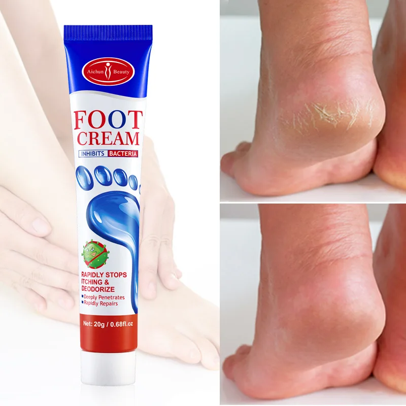 Foot Fungus Removal Cream Relieve Foot Itching Remove Beriberi Dead Skin Foot Sweat Moisturize Repair Foot Cracked Ointment