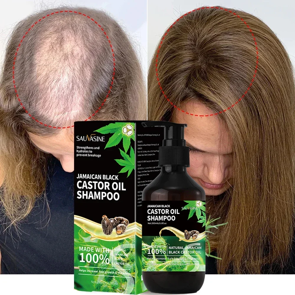 Jamaican Black Castor Oil Shampoo For Fast Hair Growth Permanently Prevents Hair Loss No Irritation To Scalp Hair Growth Product