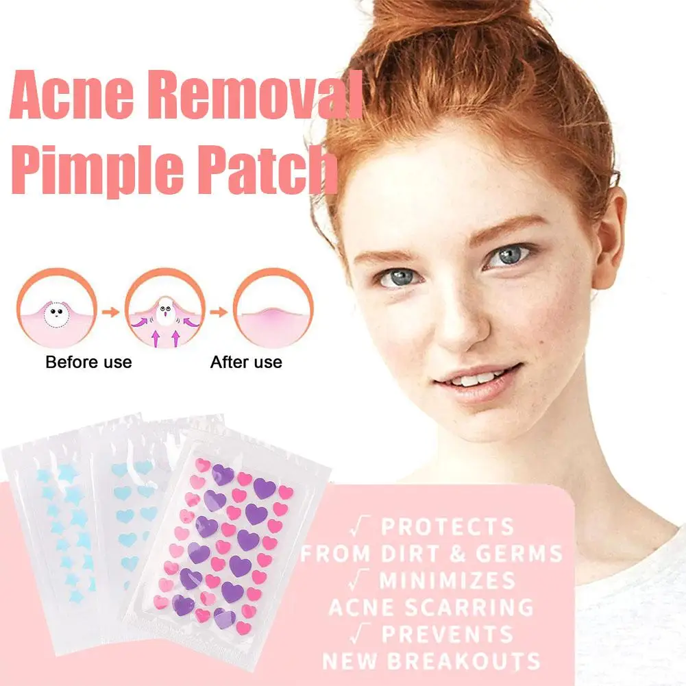 Mini Star Heart invisibile rimozione dell'acne brufolo Patch brufolo Acne Concealer Face Spot adesivi per la cura della pelle del viso strumento per l'acne di bellezza