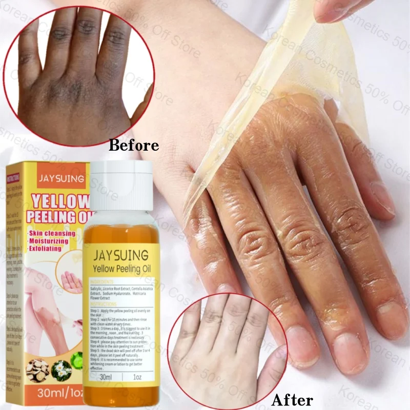 Yellow Peeling Oil Body Cleansing Exfoliation For Tender Glowing Skin Finger Joint Whitening Moisturizing Care Beauty Products