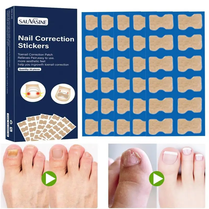 Nail Repair Patches 50pcs Comfortable And Safe Home Nail Care Products Breathable Ingrown Toenail Correction Patch Lightweight