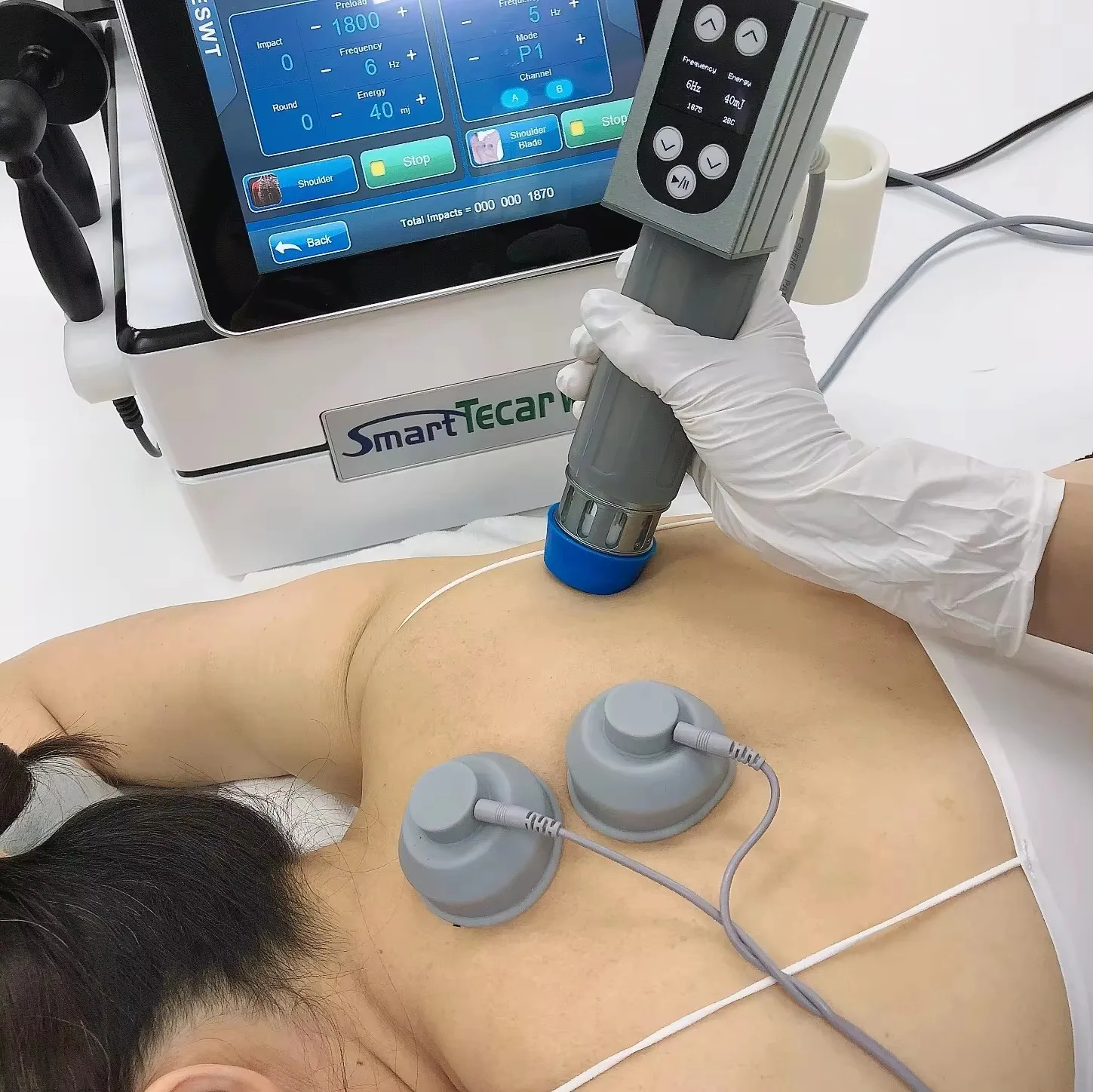 

New Smart Tecar Wave Capactive And Resistive Energy Transfer / EMS Combine Shockwave 3 In 1 Physiotherapy Machine