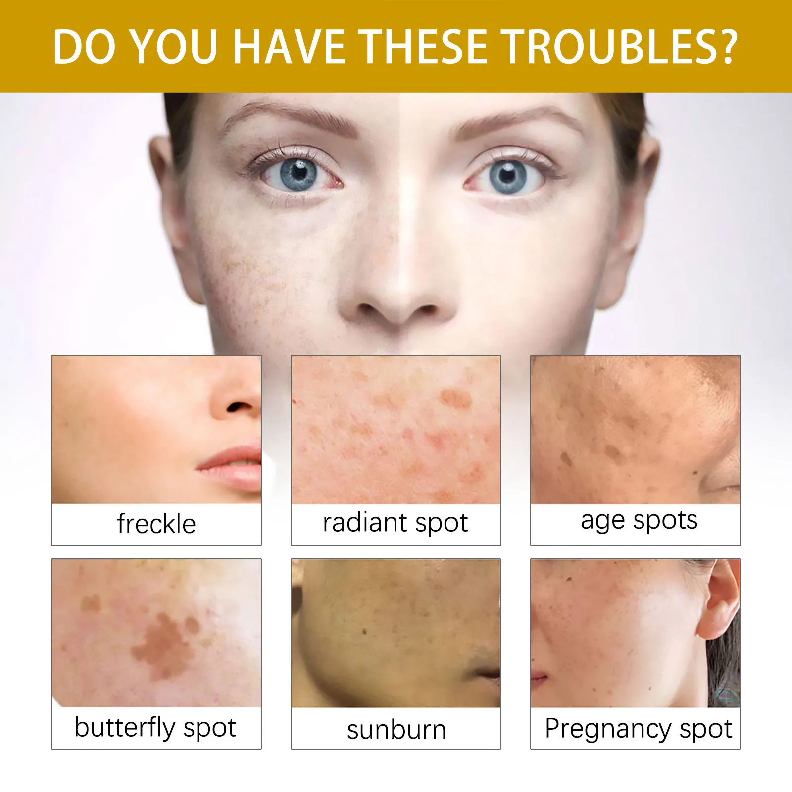 Melanina freckle óleo, melhoria facial, clarear pontos, pele cuidados